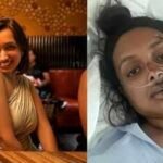 a woman booked a bike ride to work and woke up with 9 broken ribs and no spleen