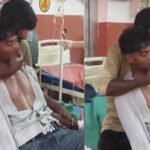 hardoi man slapped 150 times after snake bite