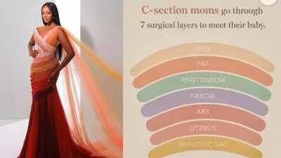c section
