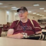 im not broken at 21 he survived burns on 85 of his body after a gas explosion years later he prepares school lunches for hundreds of students while building his dream life